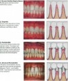 /album/periodontics/periodontics-4-jpg/